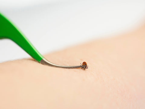 TickCheck - TickCheck Premium Tick Remover Kit