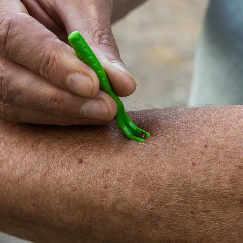 TickCheck - TickCheck Tick Remover Value 3 Pack